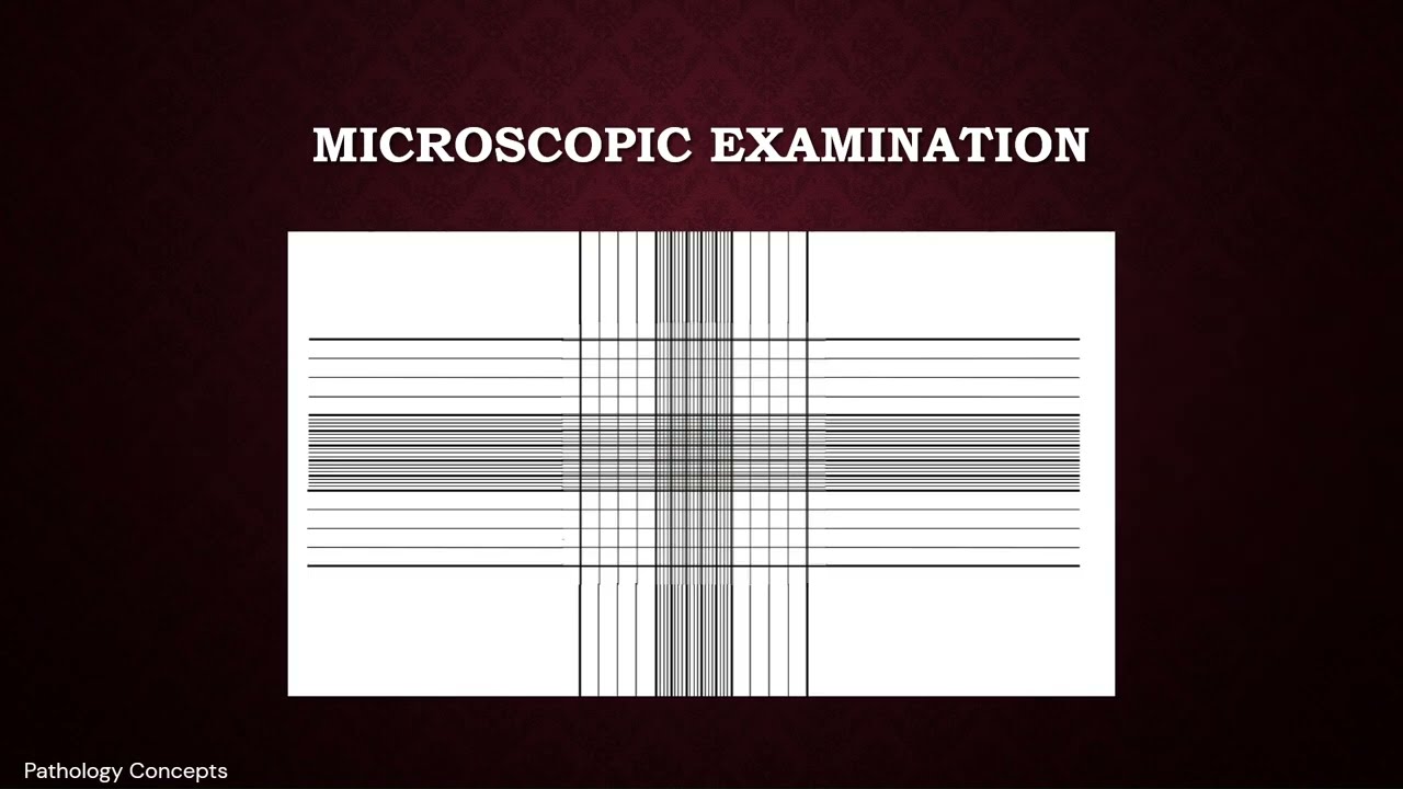 Microscopic examination of CSF | Cerebrospinal Fluid | Microscopy