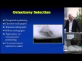 Posterior Deformity Correction: Techniques, Pearls, & Mistakes by Christopher Shaffery, M.D.