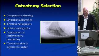 Posterior Deformity Correction: Techniques, Pearls, & Mistakes by Christopher Shaffery, M.D.