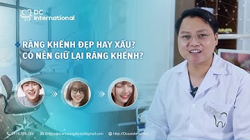 Răng Khểnh Đẹp Hay Xấu! Có Nên Giữ Lại Răng Khểnh? Niềng Răng Dr Cường