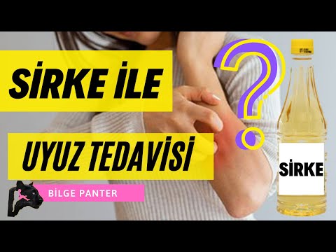 Beyaz Sirke Uyuz Tedavisi Mp3 Mp4 Indir Dur