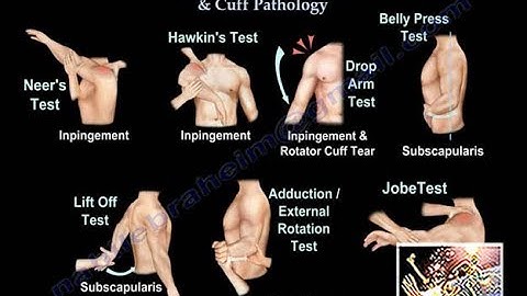 Clinical Examination Of Shoulder & Rotator Cuff - Everything You Need To Know - Dr. Nabil Ebraheim