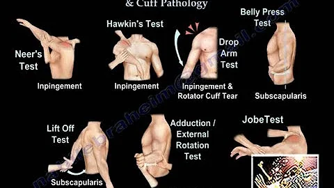 Clinical Examination Of Shoulder & Rotator Cuff - Everything You Need To Know - Dr. Nabil Ebraheim