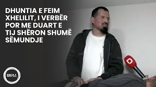 Dhuntia e Feim Xhelilit, i verbër por me duart e tij shëron shumë sëmundje