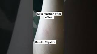 Tuberculin Skin Test