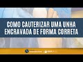 Como cauterizar uma unha encravada de forma correta