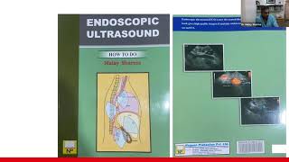 Normal Anatomy of Mediastinum - Dr. Malay Sharma screenshot 2