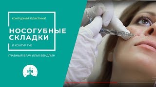 Контурная пластика носогубных складок и контура губ Контурная пластика носогубных складок и контура губ