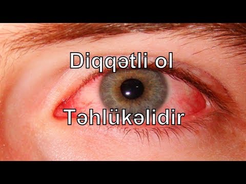 Video: Özünüzü Optimistə Necə çevirmək Olar?