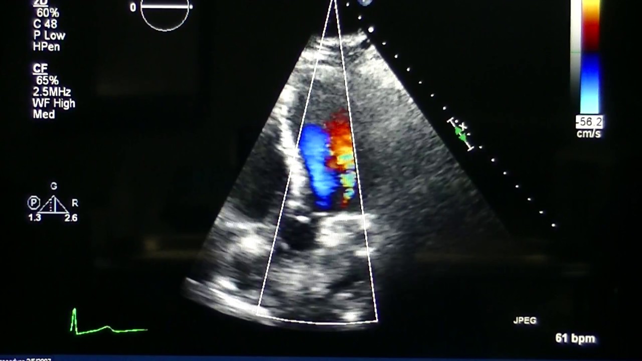 The IAC Echo: An Example Of An Echo That Meets IAC Echo Standards - YouTube