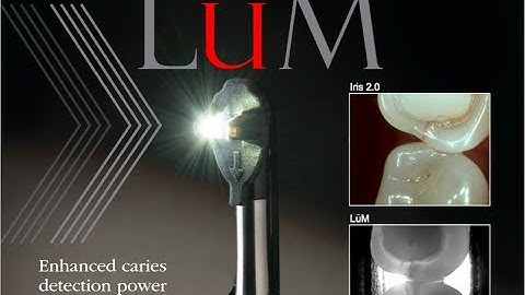 LūM Transillumination by Digital Doc Installation & Training