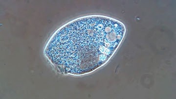 How to Identify a Microbe