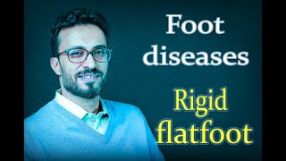 06 Foot diseases: Rigid flatfoot