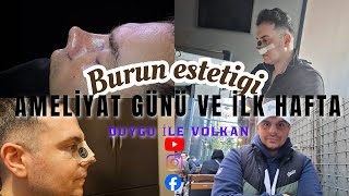 Burun Estetiği Ameliyatı Sürecimiz - Ameliyat Günü Neler Oluyor?
