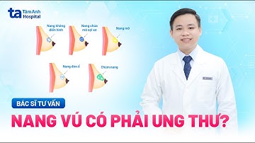 Nang vú có phải ung thư không? Nguyên nhân, dấu hiệu, phân loại và phòng ngừa | BVĐK Tâm Anh
