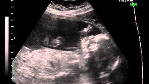 Baby Julian Sisneros