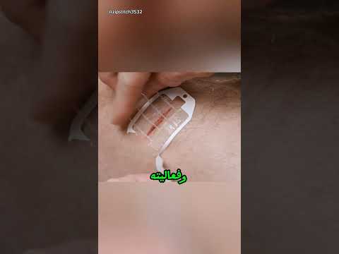 اختراع طبي يغلق الجروح في ثوان أدق من الجراحة ب8 مرات