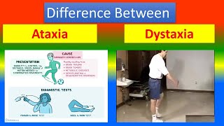 Difference Between Ataxia and Dystaxia