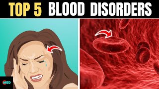 Top 5 most common blood disorders
