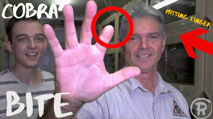 How He SURVIVED A DEADLY Snake Bite