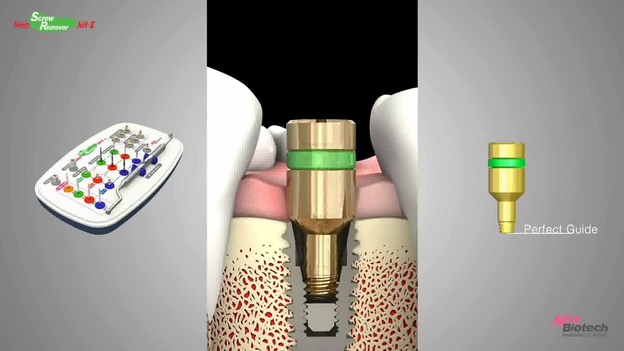 NeoBiotech Screw Remover Kit HowTo Guide YouTube