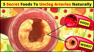 5 Secret Foods That Unclog Arteries Naturally | How To Clean Arteries And Remove Bad Cholesterol