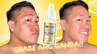 SKINCARE FOR DARK SPOTS AND ACNE BREAKOUTS! GARNIER VITAMIN C SERUM BOOSTER  REVIEW FOR 2 MONTHS!