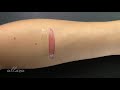 Middle of video