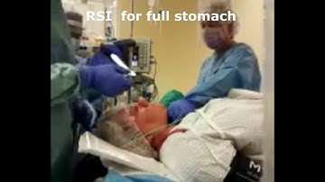 Rapid Sequence Induction in patient with BMI of 44.4