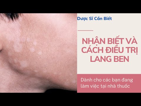 Video: Cây liễu lốm đốm cao bao nhiêu?