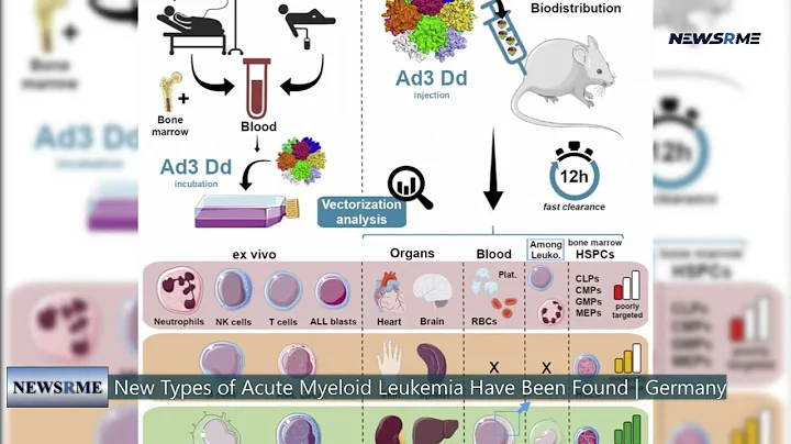 New types of acute myeloid leukemia have been foun...