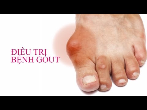 Video Bệnh gout và cách điều trị Gout - youtube