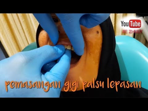 NGILU SENDI RAHANG - 3 Langkah Pemijatan adalah video tutorial pijat mandiri yang bisa dilakukan den. 
