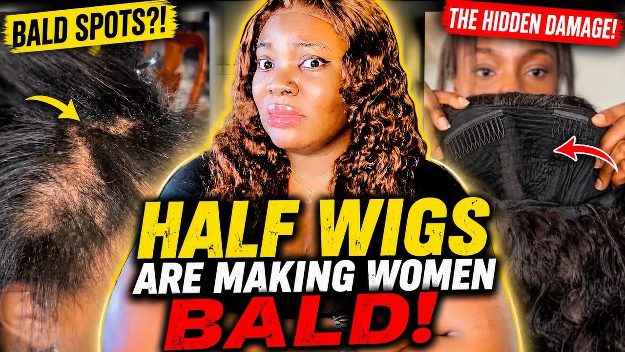 The Half Wig Epidemic: Why So Many Women Are Losing Their Hair