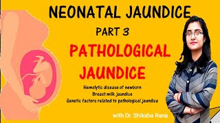 Neonatal Jaundice-Pathological Jaundice Part -3 with Dr. Shiksha Rana #balroglectureseries #BAMS