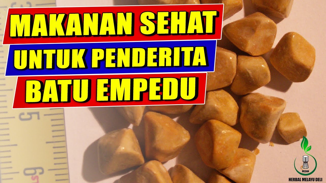 3 Jenis Makanan yang Aman dan Sehat Untuk Pengidap Batu 