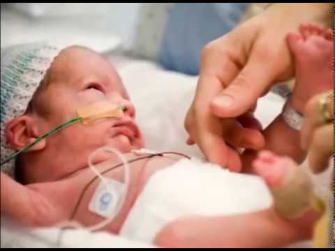 virus sincitial respiratorio en bebes prematuros