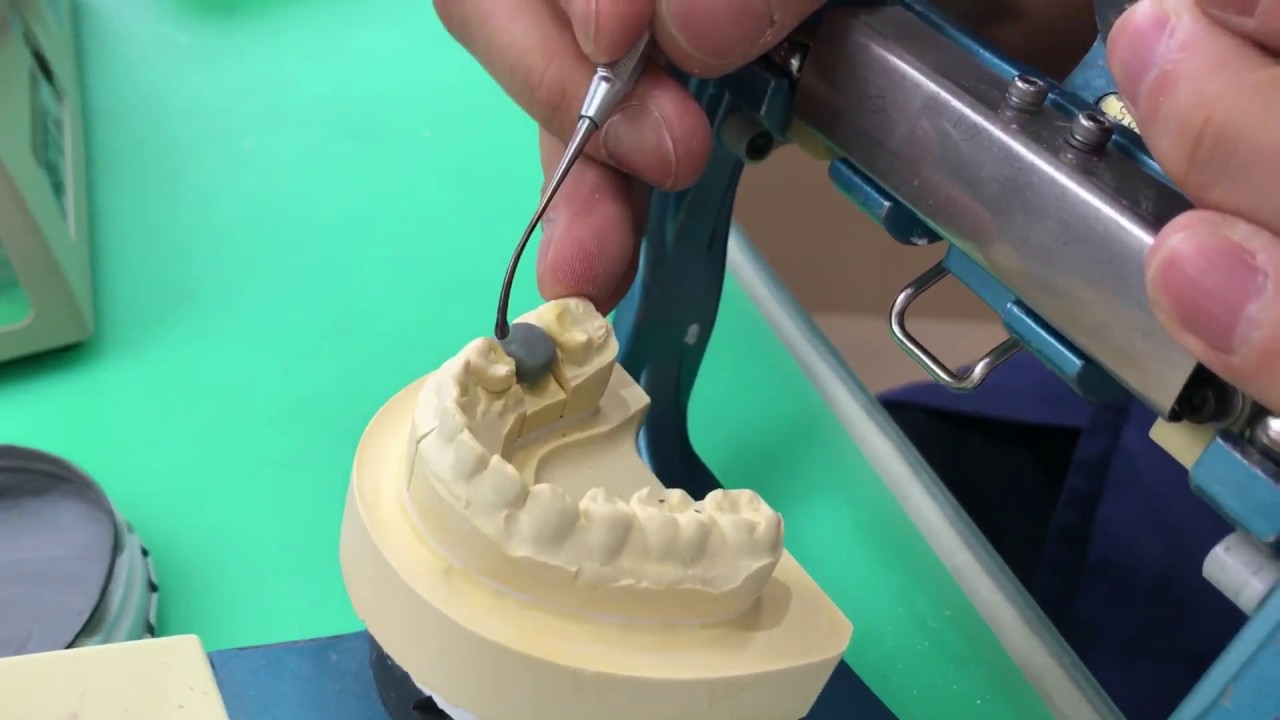 6番ワックスアップ