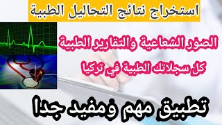 استخراج نتائج التحاليل الطبية في تركيا.تطبيق مهم لجميع المقيمين في تركيا