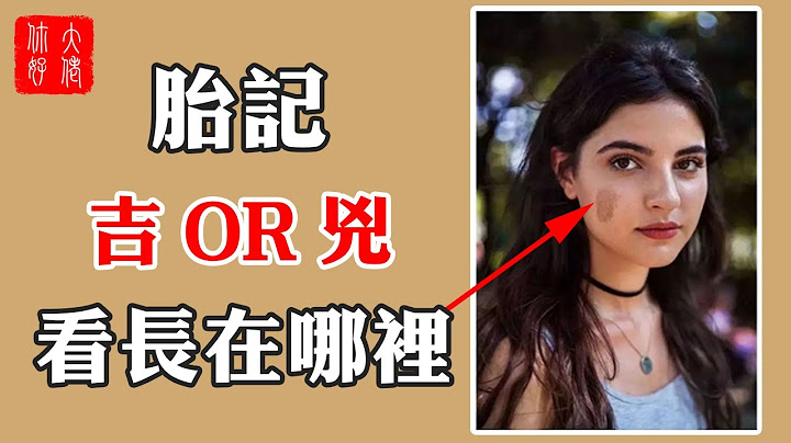 【胎记】胎记预示命运？是吉还是凶，看看长在哪个部位！#大佬你好啊 - 天天要闻