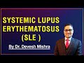 Systemic Lupus Erythematosus  (SLE) by Dr. Devesh Mishra.