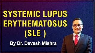 Systemic Lupus Erythematosus (SLE) by Dr. Devesh Mishra.