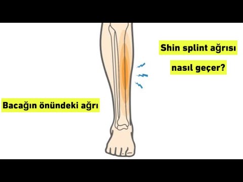 Shin Splint Nedir ? Bu Ağrı Nasıl Geçer ? 2 Kolay Egzersiz