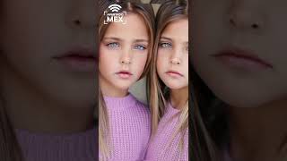 ¿Cómo lucen las gemelas más hermosas del mundo 12 años después? #gemelas #hermosas #apartadomex