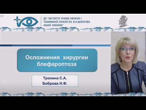 Осложнения хирургии блефароптоза, докладчик Тронина С.А.