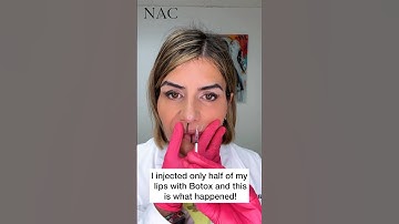 #lipflip #lipflipbotox #botoxtraining #drbitafarrell #naturalaestheticscenter