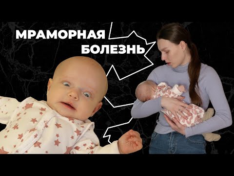 МРАМОРНАЯ БОЛЕЗНЬ I История Аделины Ертмаковой