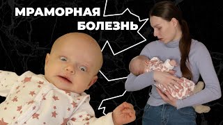 МРАМОРНАЯ БОЛЕЗНЬ I История Аделины Ертмаковой