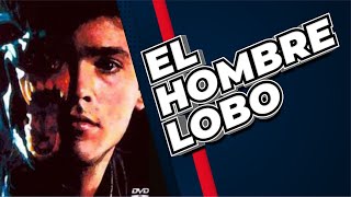 El hombre lobo que pasó con la famosa serie de los 80s