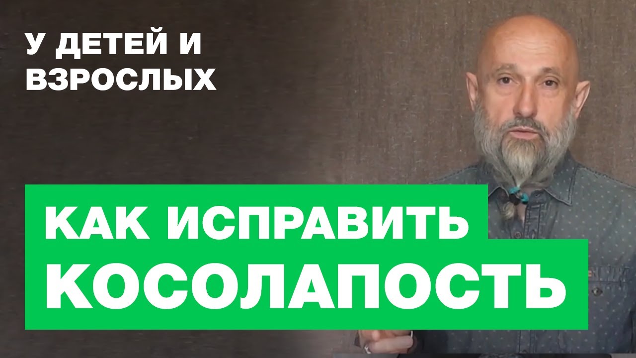 Косолапость - Как Исправить Деформацию у Ребенка или у Взрослого - YouTube